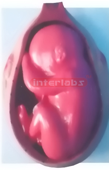 UTERUS WITH EMBRYO (10 MONTH)